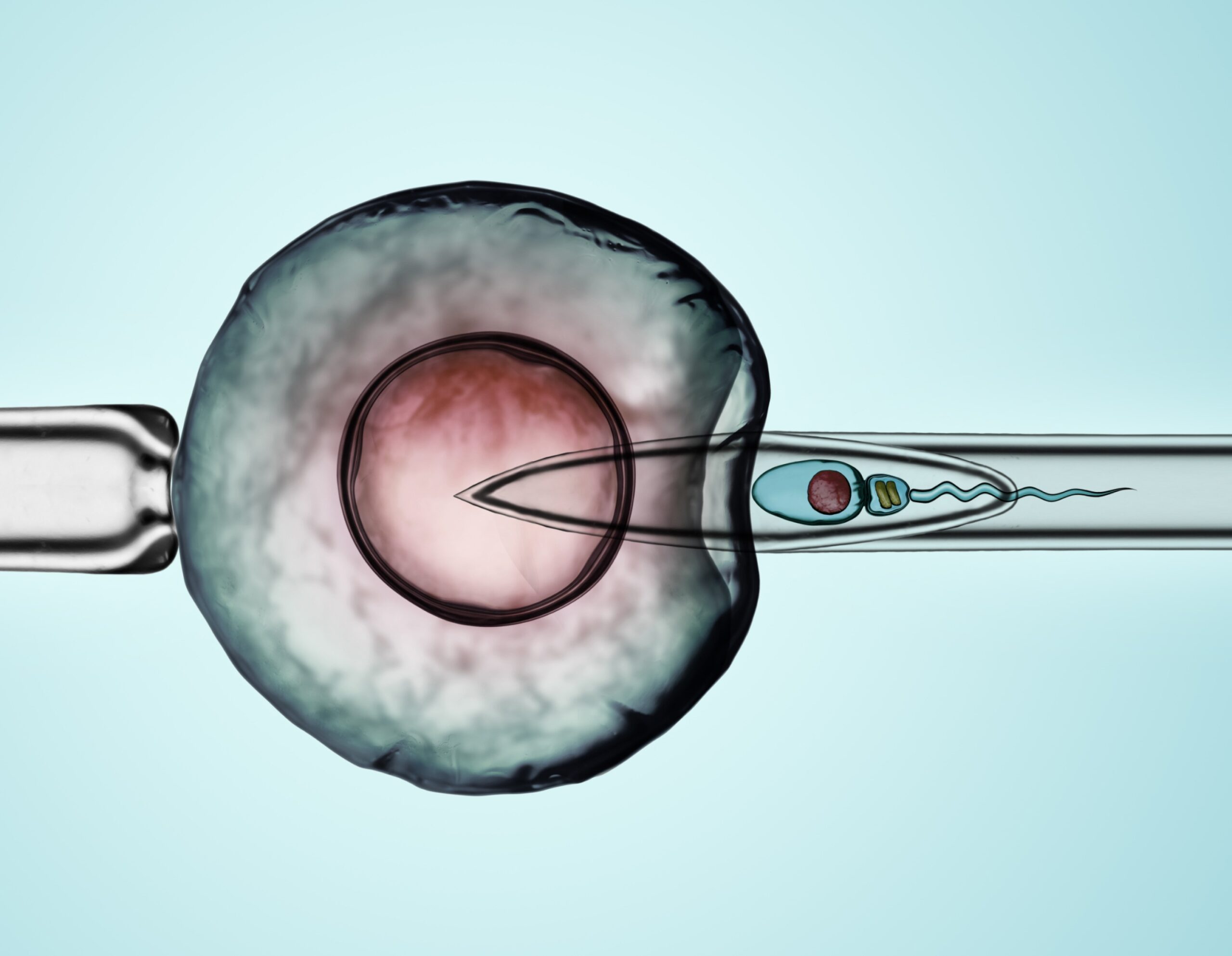 ICSI à Paris | fécondation in vitro icsi | Gynécologue spécialiste en fértilité | Dr Krief